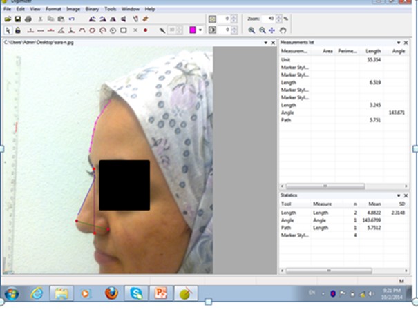Figure 2. Measuring the desired dimensions in Digimizer software